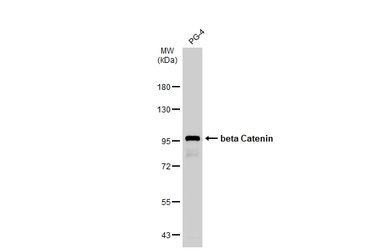 Anti-beta Catenin antibody [N1N2-2], N-term used in Western Blot (WB). GTX101435