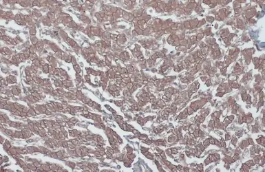 Anti-beta Catenin antibody [N1N2-2], N-term used in IHC (Paraffin sections) (IHC-P). GTX101435