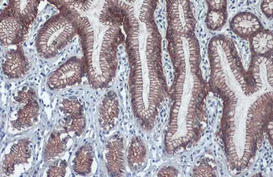 Anti-beta Catenin antibody [N1N2-2], N-term used in IHC (Paraffin sections) (IHC-P). GTX101435