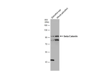 Anti-beta Catenin antibody [N1N2-2], N-term used in Western Blot (WB). GTX101435