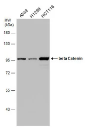 Anti-beta Catenin antibody [N1N2-2], N-term used in Western Blot (WB). GTX101435