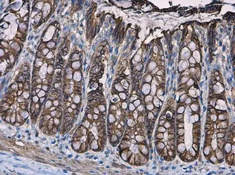 Anti-beta Catenin antibody [N1N2-2], N-term used in IHC (Paraffin sections) (IHC-P). GTX101435