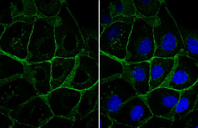 Anti-beta Catenin antibody [N1N2-2], N-term used in Immunocytochemistry/ Immunofluorescence (ICC/IF). GTX101435