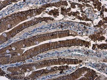 Anti-beta Catenin antibody [N1N2-2], N-term used in IHC (Paraffin sections) (IHC-P). GTX101435