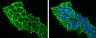 Anti-beta Catenin antibody [N1N2-2], N-term used in Immunocytochemistry/ Immunofluorescence (ICC/IF). GTX101435