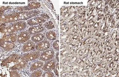 Anti-beta Catenin antibody [N1N2-2], N-term used in IHC (Paraffin sections) (IHC-P). GTX101435