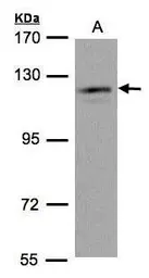 Anti-USP11 antibody [N1N2], N-term used in Western Blot (WB). GTX101446