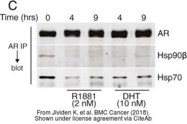 Anti-Hsp90 beta antibody used in Western Blot (WB). GTX101448