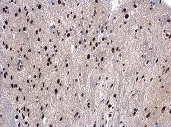 Anti-BAT1 antibody [N1C2] used in IHC (Paraffin sections) (IHC-P). GTX101475