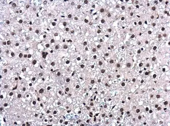 Anti-BAT1 antibody [N1C2] used in IHC (Paraffin sections) (IHC-P). GTX101475