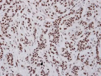 Anti-BAT1 antibody [N1C2] used in IHC (Paraffin sections) (IHC-P). GTX101475