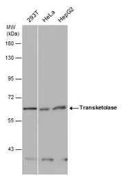 Anti-Transketolase antibody [N3C2], Internal used in Western Blot (WB). GTX101477