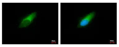 Anti-ENSA antibody used in Immunocytochemistry/ Immunofluorescence (ICC/IF). GTX101493