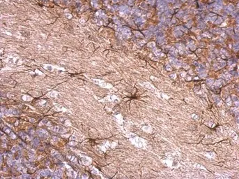 Anti-ENSA antibody used in IHC (Paraffin sections) (IHC-P). GTX101493