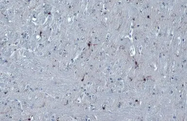 Anti-Iba1 antibody used in IHC (Paraffin sections) (IHC-P). GTX101495