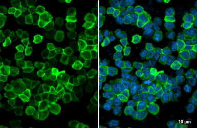 Anti-Iba1 antibody used in Immunocytochemistry/ Immunofluorescence (ICC/IF). GTX101495