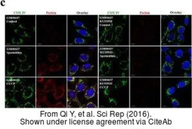 Anti-COX4 antibody used in Immunocytochemistry/ Immunofluorescence (ICC/IF). GTX101499