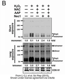 Anti-COX4 antibody used in Western Blot (WB). GTX101499