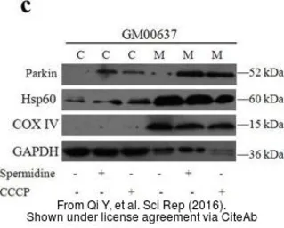 Anti-COX4 antibody used in Western Blot (WB). GTX101499