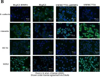 Anti-SOX2 antibody [N1C3] used in Immunocytochemistry/ Immunofluorescence (ICC/IF). GTX101507