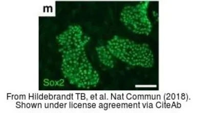 Anti-SOX2 antibody [N1C3] used in Immunocytochemistry/ Immunofluorescence (ICC/IF). GTX101507