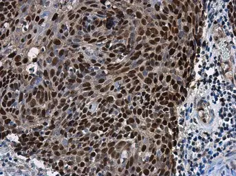 Anti-SOX2 antibody [N1C3] used in IHC (Paraffin sections) (IHC-P). GTX101507