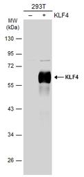 Anti-KLF4 antibody used in Western Blot (WB). GTX101509