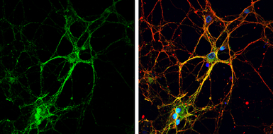 Anti-GAP43 antibody used in Immunocytochemistry/ Immunofluorescence (ICC/IF). GTX101535