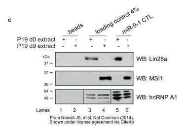 Anti-Musashi 1 antibody [N3C3] used in Western Blot (WB). GTX101540