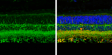 Anti-CRABP2 antibody [N1C3] used in IHC (Paraffin sections) (IHC-P). GTX101551