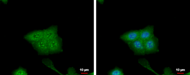 Anti-CRABP2 antibody [N1C3] used in Immunocytochemistry/ Immunofluorescence (ICC/IF). GTX101551