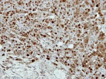 Anti-CRABP2 antibody [N1C3] used in IHC (Paraffin sections) (IHC-P). GTX101551