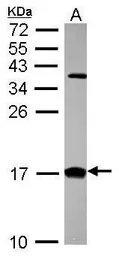 Anti-CRABP2 antibody [N1C3] used in Western Blot (WB). GTX101551