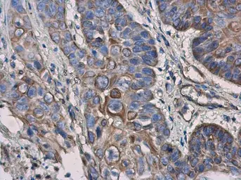 Anti-IL3 Receptor alpha antibody [N2C2], Internal used in IHC (Paraffin sections) (IHC-P). GTX101563