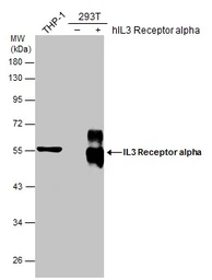 Anti-IL3 Receptor alpha antibody [N2C2], Internal used in Western Blot (WB). GTX101563