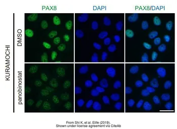 Anti-PAX8 antibody used in Immunocytochemistry/ Immunofluorescence (ICC/IF). GTX101583