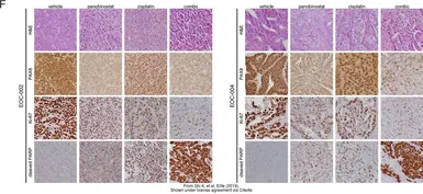 Anti-PAX8 antibody used in Immunohistochemistry (IHC). GTX101583