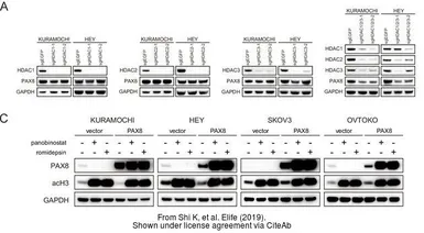 Anti-PAX8 antibody used in Western Blot (WB). GTX101583