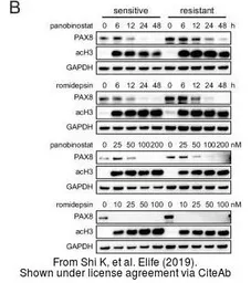 Anti-PAX8 antibody used in Western Blot (WB). GTX101583