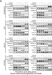 Anti-PAX8 antibody used in Western Blot (WB). GTX101583