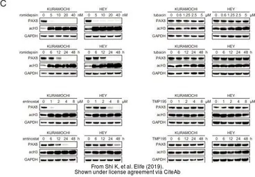 Anti-PAX8 antibody used in Western Blot (WB). GTX101583