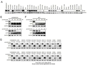 Anti-PAX8 antibody used in Western Blot (WB). GTX101583