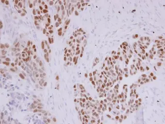 Anti-PAX8 antibody used in IHC (Paraffin sections) (IHC-P). GTX101583