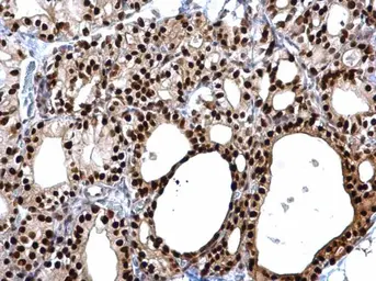 Anti-PAX8 antibody used in IHC (Paraffin sections) (IHC-P). GTX101583