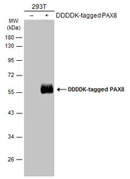 Anti-PAX8 antibody used in Western Blot (WB). GTX101583