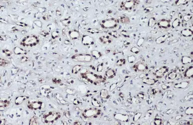 Anti-PAX8 antibody used in IHC (Paraffin sections) (IHC-P). GTX101583