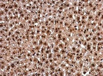 Anti-PAX8 antibody used in IHC (Paraffin sections) (IHC-P). GTX101583