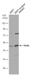 Anti-PAX8 antibody used in Western Blot (WB). GTX101583