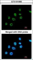 Anti-PAX8 antibody used in Immunocytochemistry/ Immunofluorescence (ICC/IF). GTX101583