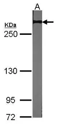 Anti-NOTCH2 antibody [C2], C-term used in Western Blot (WB). GTX101593